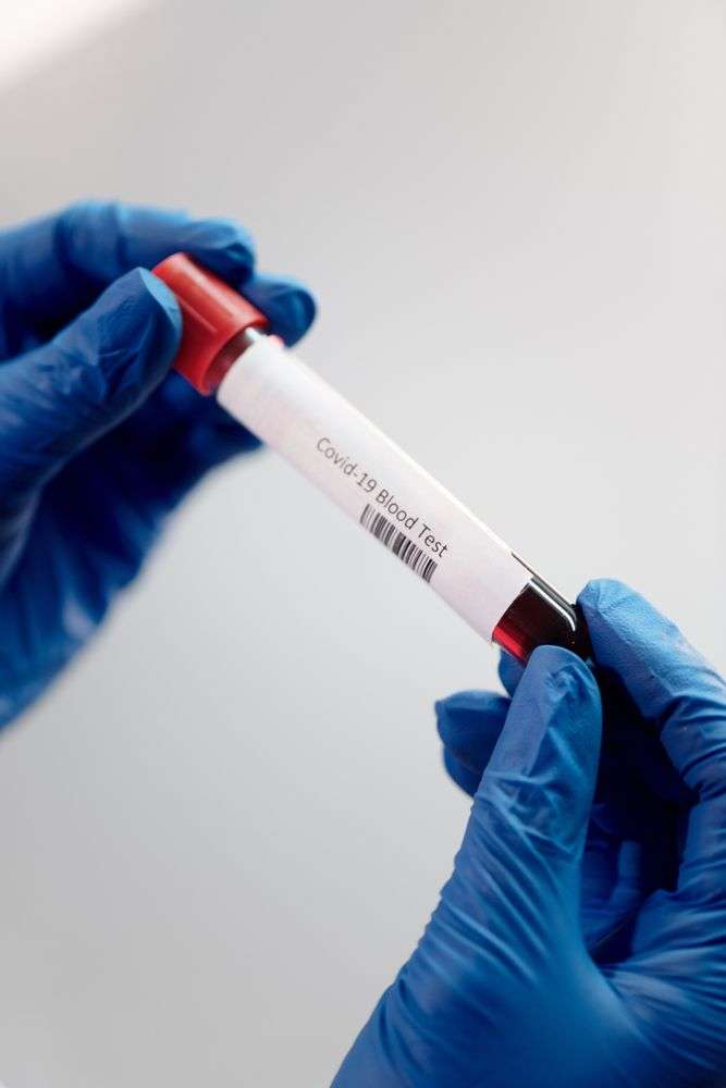 Gloved medical worker performing a nasal swab diagnostic test, representative of COVID-19 testing procedures