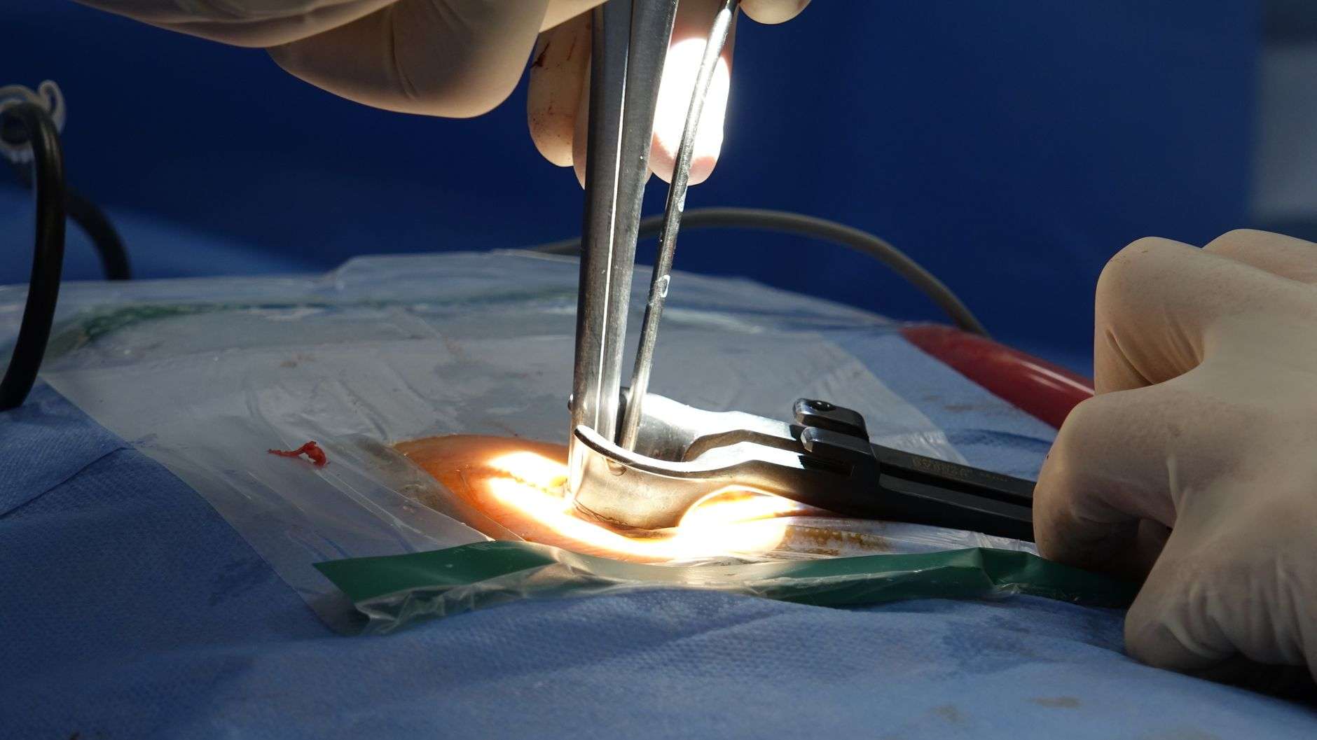 Medical professionals reviewing spine surgery research at a conference