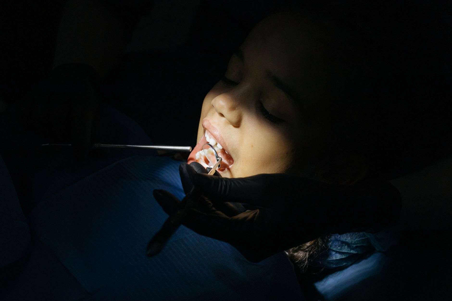 Close-up of a child undergoing a dental exam at a clinic, highlighting dental care procedures.